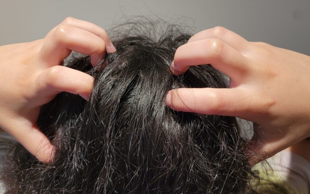 Nurturing Your Scalp Microbiome: Ahimsa’s Indian Gooseberry Hair Care for Dry, Irritated, and Itchy Scalp